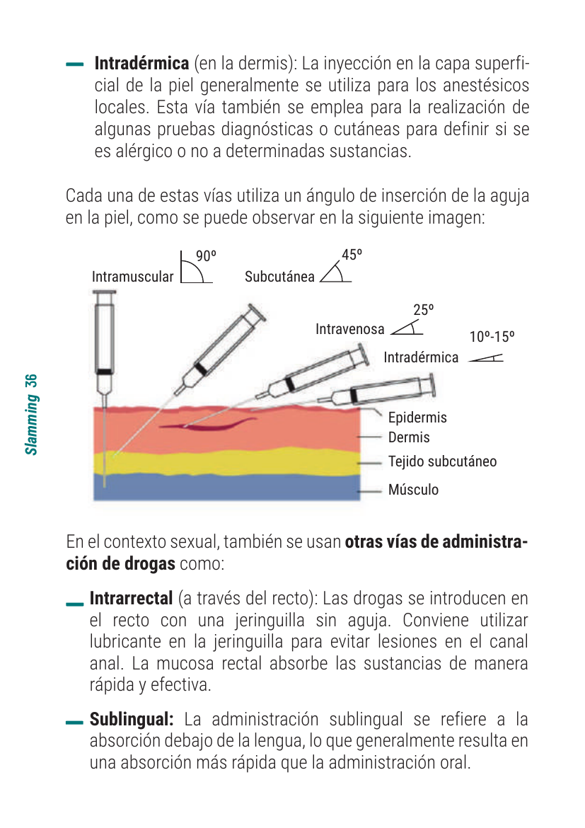 Esquema de ángulos de inserción según vía: intramuscular 90°, subcutánea 45°, intravenosa 25°, intradérmica 10-15°